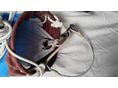 GENNAKER (ASSZIMETRIKUS SPINNAKER) - SAILS 2010 - 6