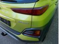 HYUNDAI KONA 2018/2 - 6