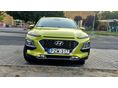 HYUNDAI KONA 1.0 T-GDi Premium